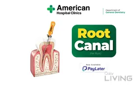 Root Canal Treatment - Just for 499 QAR